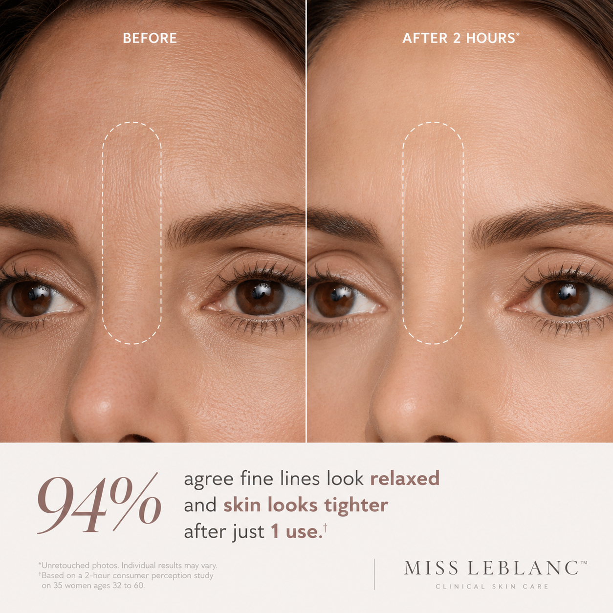 Peptide Skinjection Face + Eye Tape