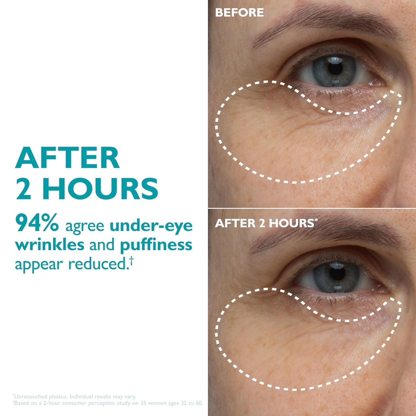 Peptide Skinjection Face + Eye Tape