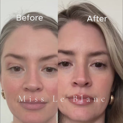 Peptide Skinjection Face + Eye Tape